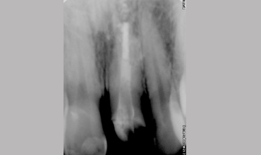 Orthodontic services in Anand                        